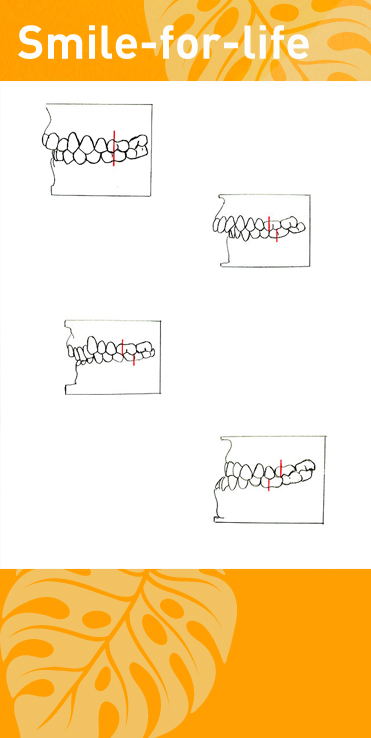 fehlstellungen-kiefer-kieferorthopäde-ingolstadt