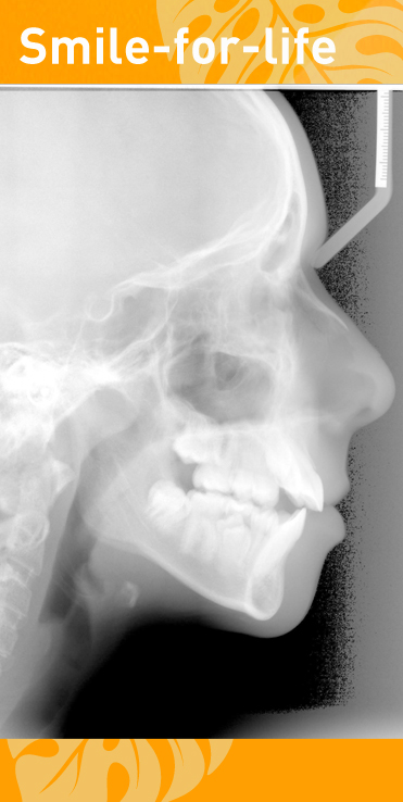 roentgen-ingolstadt-kieferorthopaede